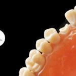 illustration of a dental graft procedure performed at Mera Dental Clinic, showing a dentist carefully placing grafting material in a patient's gum to restore lost bone tissue. The setting is a clean, professional dental office, emphasizing precision and patient care.